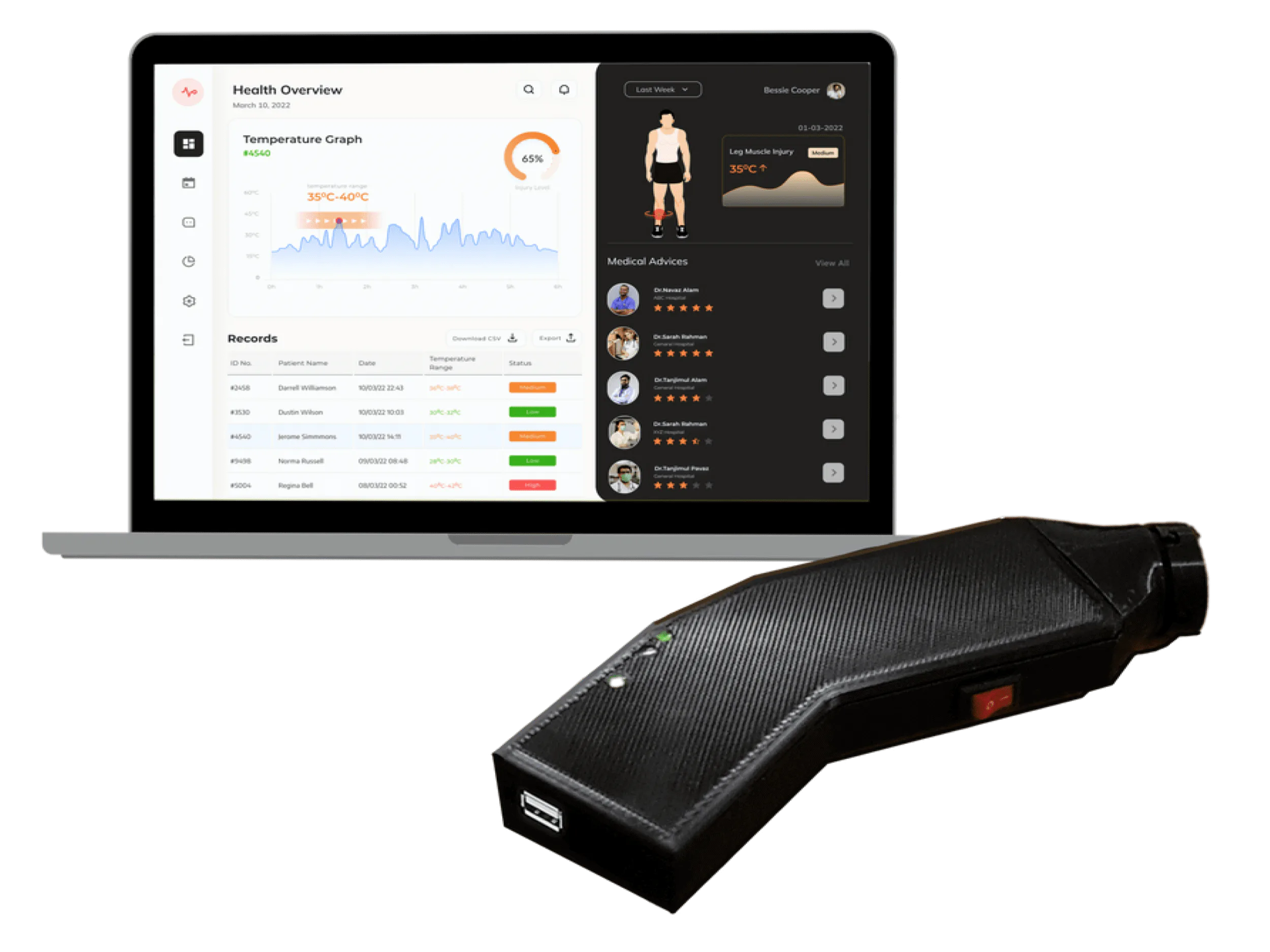 BioThermal detection for internal injury monitoring